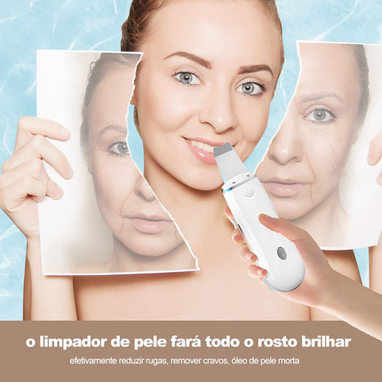 Removedor de Cravos e Limpeza Facial BDZ Skin - Shop Bem